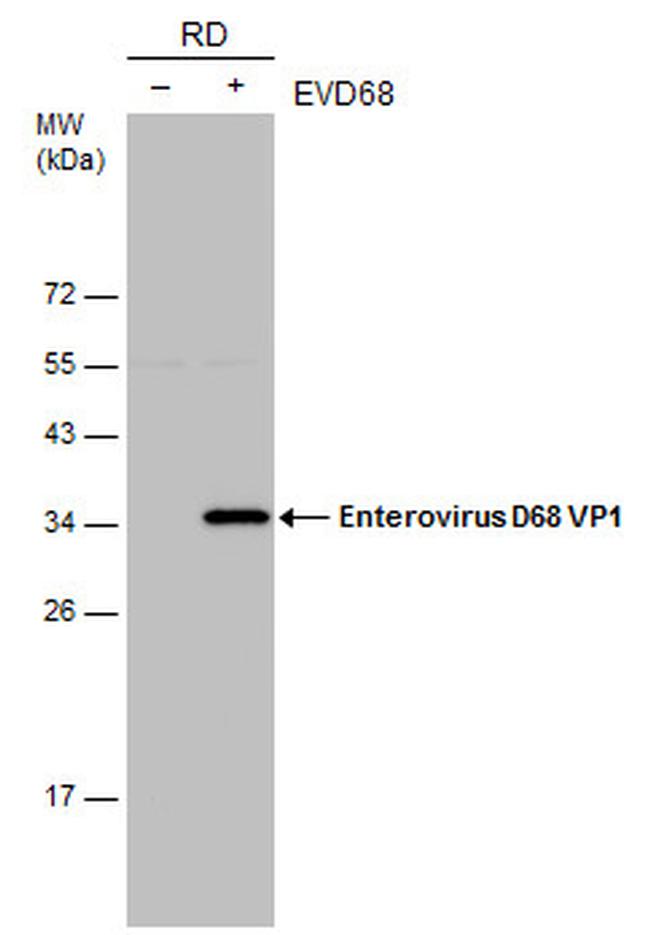 Enterovirus D68 VP1 Antibody in Western Blot (WB)