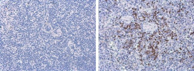 Porcine Circovirus Type 2 Capsid Antibody in Immunohistochemistry (Paraffin) (IHC (P))