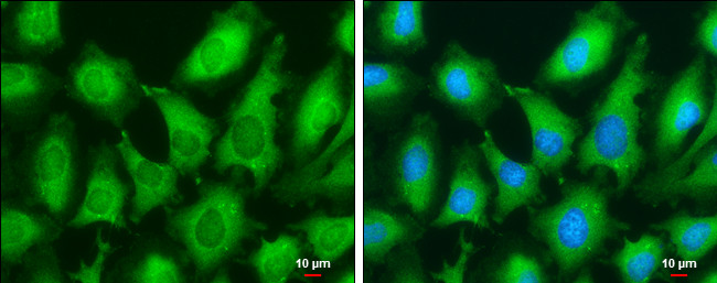 HPV Type 18 E7 Antibody in Immunocytochemistry (ICC/IF)