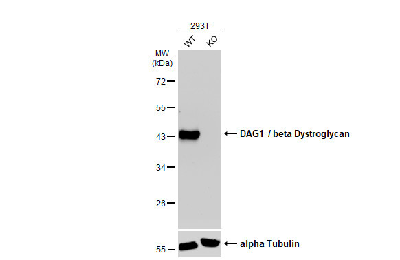beta Dystroglycan Antibody in Western Blot (WB)