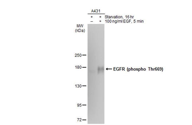 Phospho-EGFR (Thr669) Antibody in Western Blot (WB)