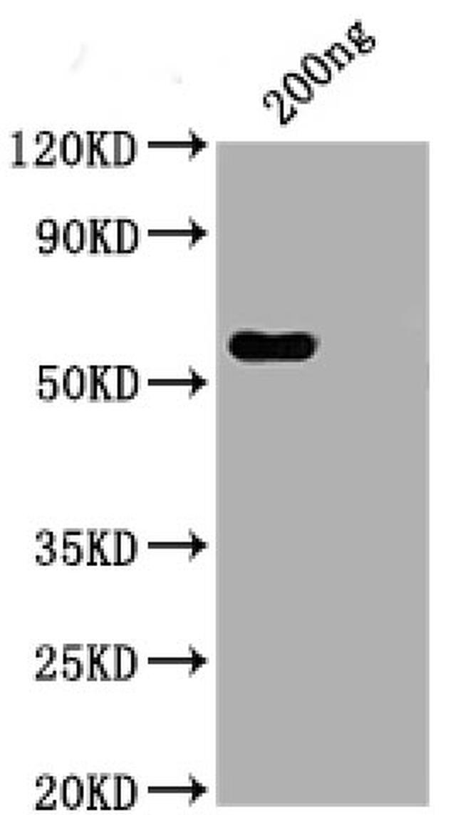 SARS-CoV-2 Nucleocapsid Chimeric Antibody in Western Blot (WB)