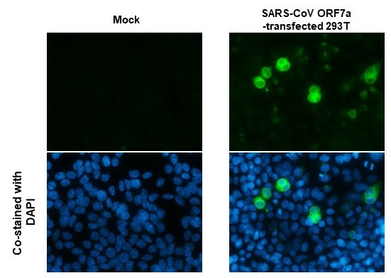 SARS-CoV/SARS-CoV-2 ORF7a Antibody in Immunocytochemistry (ICC/IF)