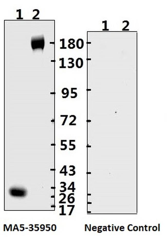 SARS-CoV-2 Spike Protein (S1/S2) Antibody in Western Blot (WB)