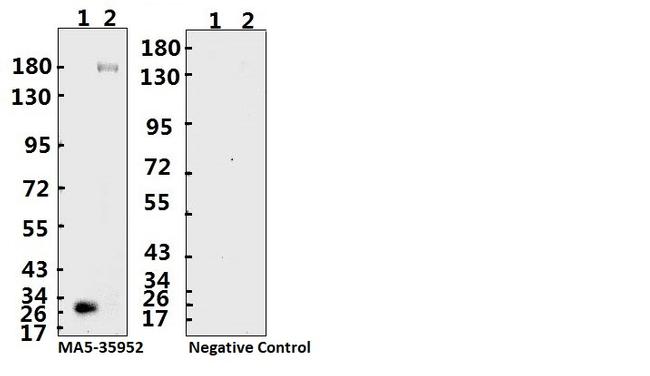 SARS-CoV-2 Spike Protein (S1/S2) Antibody in Western Blot (WB)