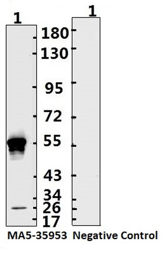 SARS-CoV-2 Nucleocapsid Antibody in Western Blot (WB)