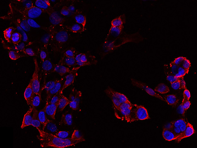 Chromogranin A Antibody in Immunocytochemistry (ICC/IF)