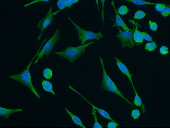 Leptin Antibody in Immunocytochemistry (ICC/IF)