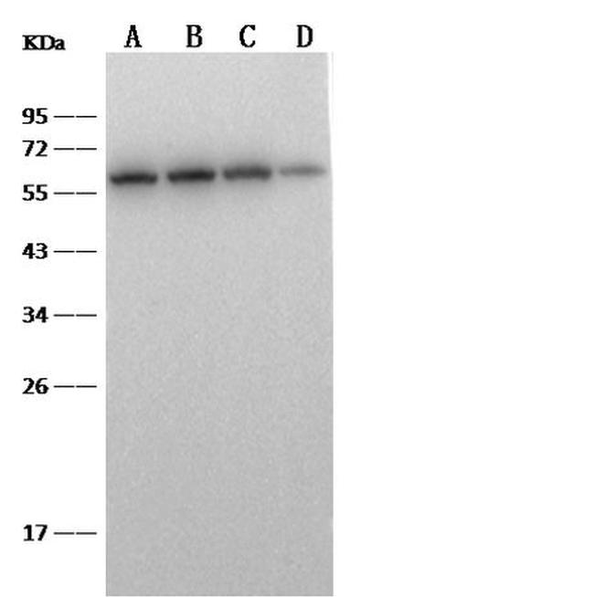 CD5 Antibody in Western Blot (WB)