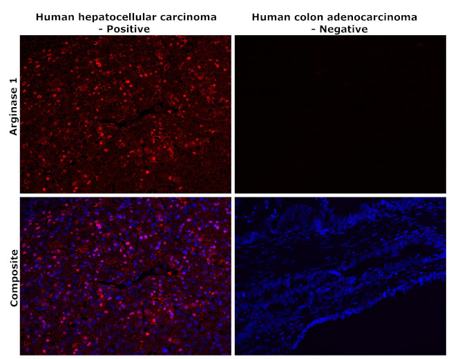 Arginase 1 Antibody in Immunohistochemistry (Paraffin) (IHC (P))