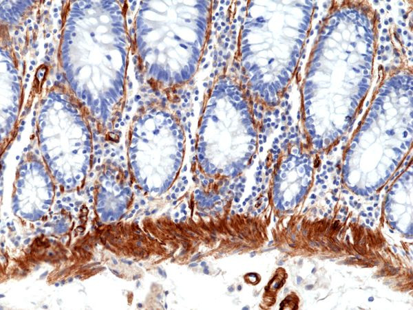 Caldesmon Antibody in Immunohistochemistry (Paraffin) (IHC (P))