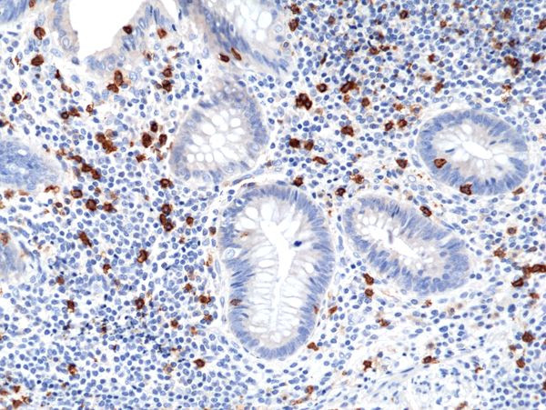 CD8a Antibody in Immunohistochemistry (Paraffin) (IHC (P))