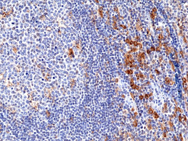 CD33 Antibody in Immunohistochemistry (Paraffin) (IHC (P))