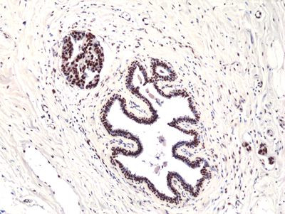 FOXP1 Antibody in Immunohistochemistry (Paraffin) (IHC (P))