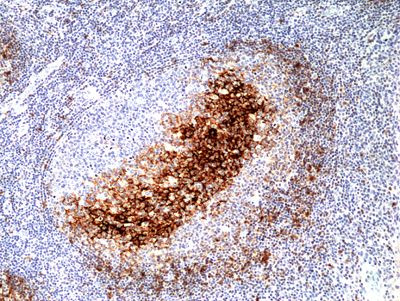 CD23 Antibody in Immunohistochemistry (Paraffin) (IHC (P))