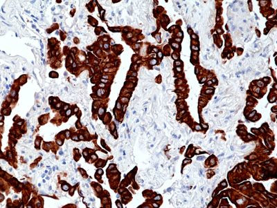 Cytokeratin 7 Antibody in Immunohistochemistry (Paraffin) (IHC (P))