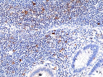 ICOS (CD278) Antibody in Immunohistochemistry (Paraffin) (IHC (P))