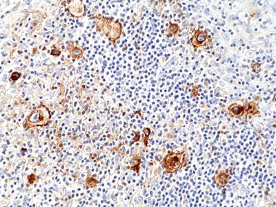 CD25 Antibody in Immunohistochemistry (Paraffin) (IHC (P))
