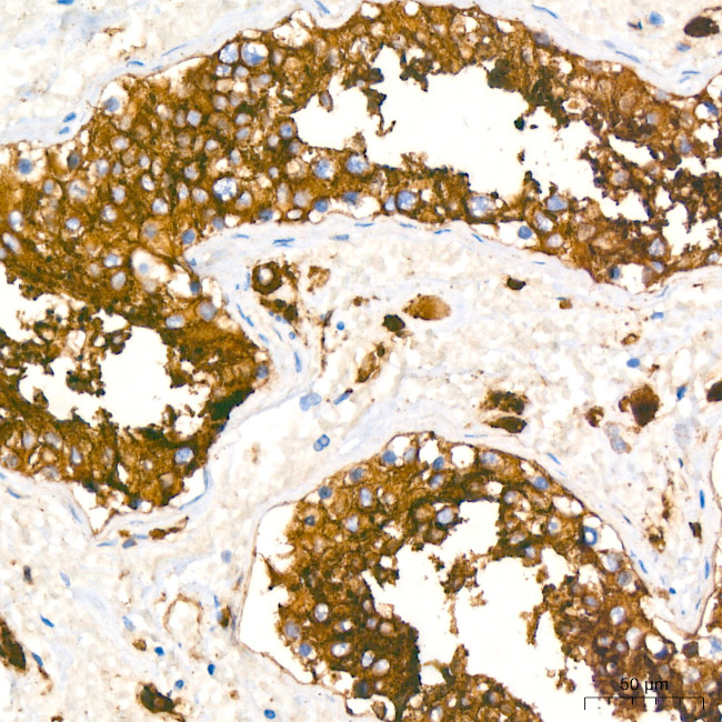 ACE2 Antibody in Immunohistochemistry (Paraffin) (IHC (P))