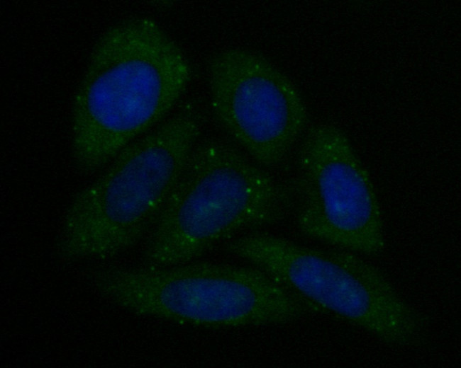 CAPZA1 Antibody in Immunocytochemistry (ICC/IF)