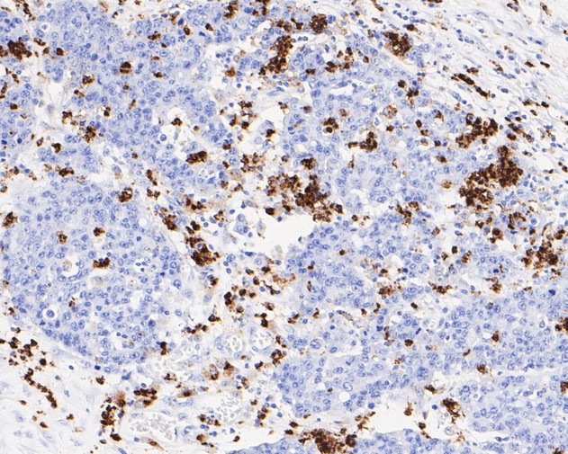 Lysozyme Antibody in Immunohistochemistry (Paraffin) (IHC (P))