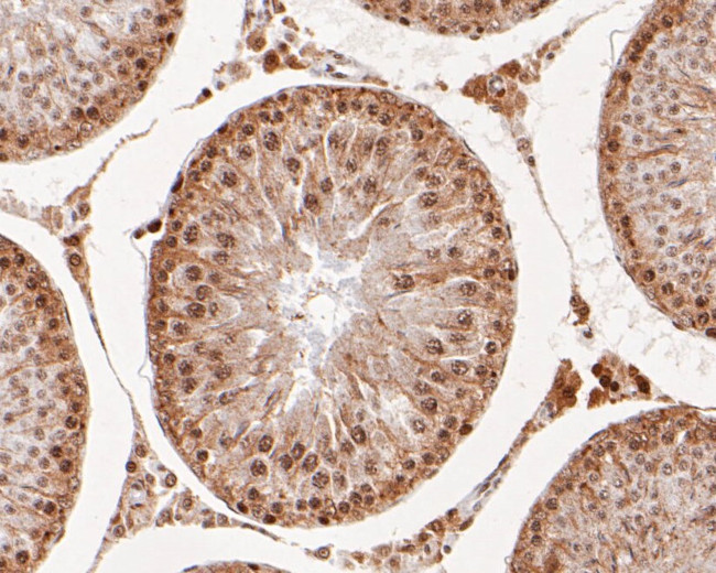 RAP80 Monoclonal Antibody A1B11 MA5 36117 rap80-monoclonal-antibody-a1b11-ma5-36117