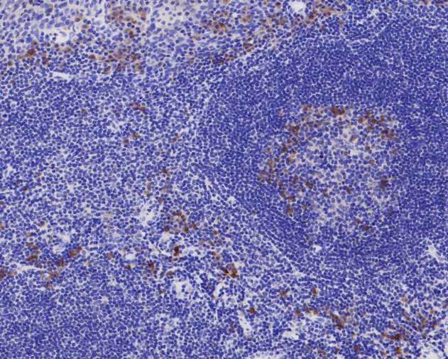 CHI3L1 Antibody in Immunohistochemistry (Paraffin) (IHC (P))