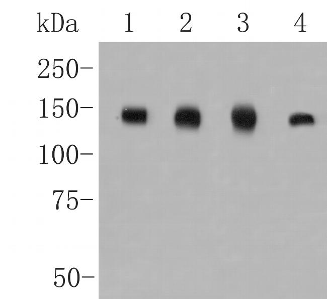 CLSTN1 Antibody in Western Blot (WB)