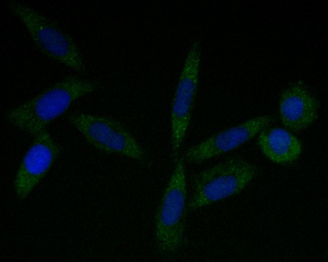 Tropomodulin 2 Antibody in Immunocytochemistry (ICC/IF)