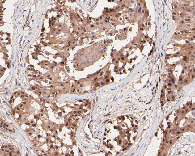 MGMT Antibody in Immunohistochemistry (Paraffin) (IHC (P))