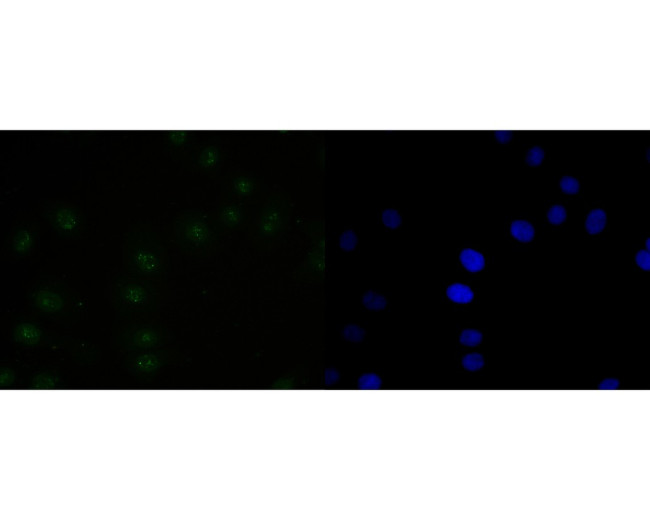 PAX2 Antibody in Immunocytochemistry (ICC/IF)