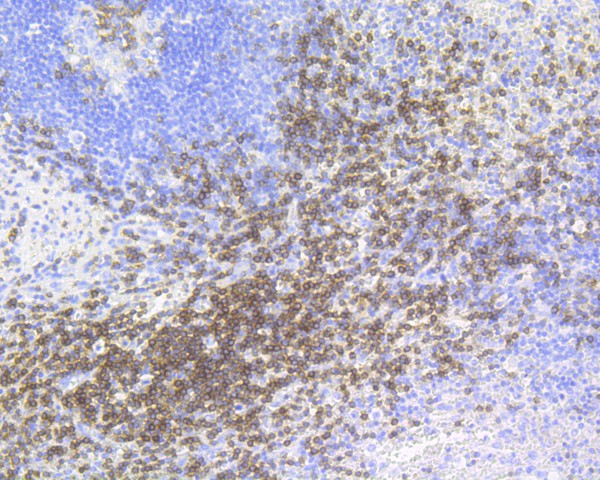 CD3 epsilon Antibody in Immunohistochemistry (Paraffin) (IHC (P))