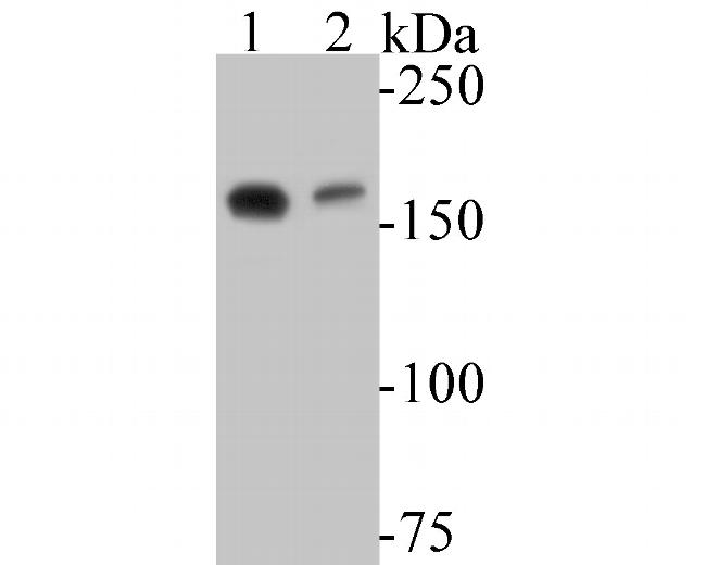ARHGAP5 Antibody in Western Blot (WB)