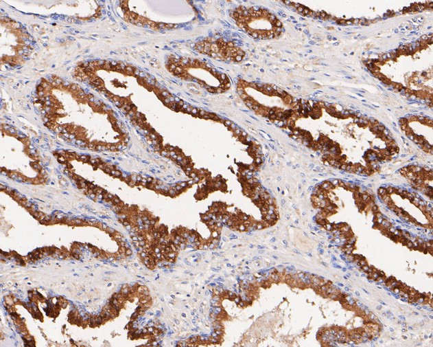 beta glucuronidase Antibody in Immunohistochemistry (Paraffin) (IHC (P))