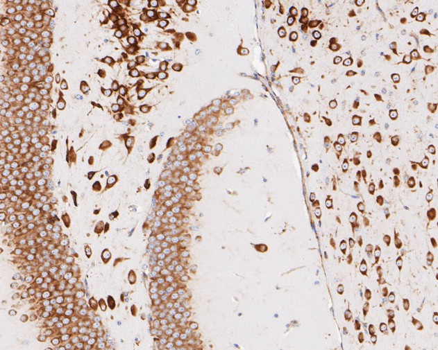 RPL7A Antibody in Immunohistochemistry (Paraffin) (IHC (P))