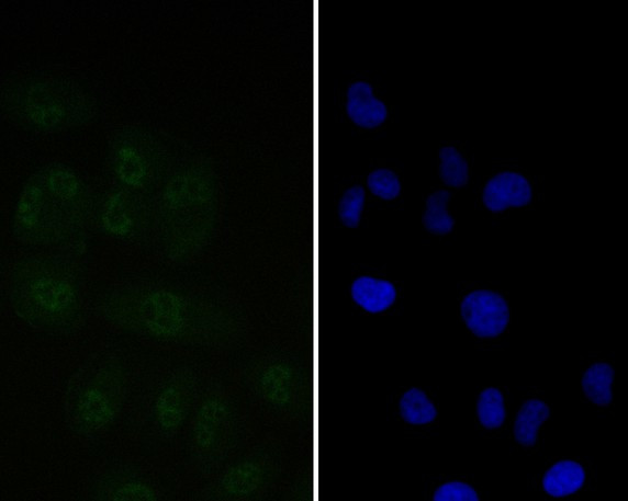 Tat-SF1 Antibody in Immunocytochemistry (ICC/IF)
