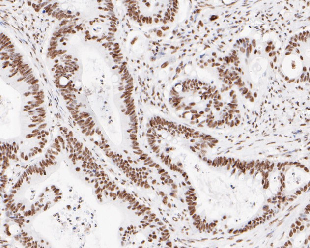 XPD Antibody in Immunohistochemistry (Paraffin) (IHC (P))