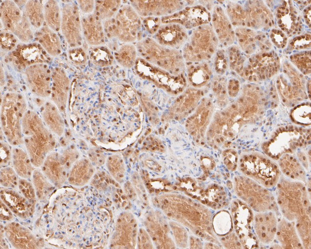 RANBP9 Antibody in Immunohistochemistry (Paraffin) (IHC (P))