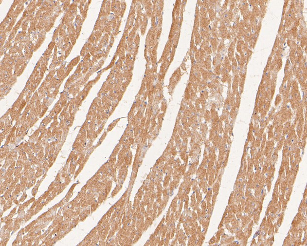 PDLIM1 Antibody in Immunohistochemistry (Paraffin) (IHC (P))