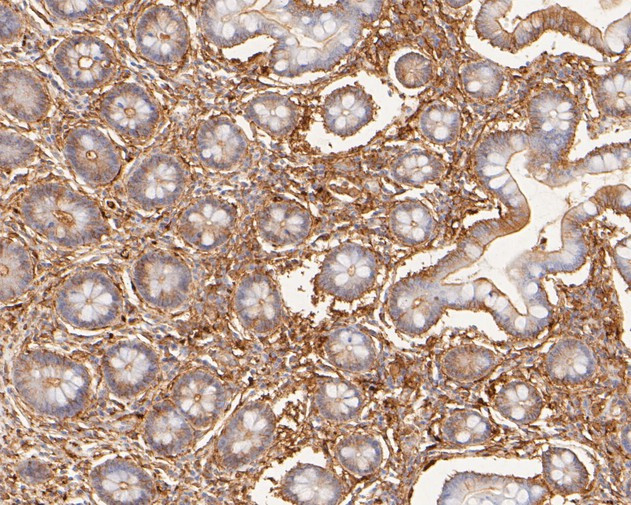 LPP Antibody in Immunohistochemistry (Paraffin) (IHC (P))