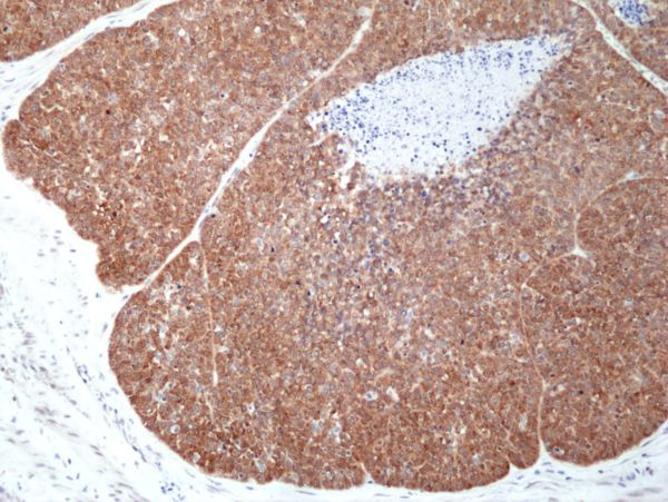MSI2 Antibody in Immunohistochemistry (Paraffin) (IHC (P))