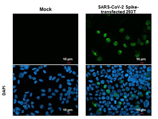 SARS-CoV-2 Spike Protein S1 Antibody in Immunocytochemistry (ICC/IF)