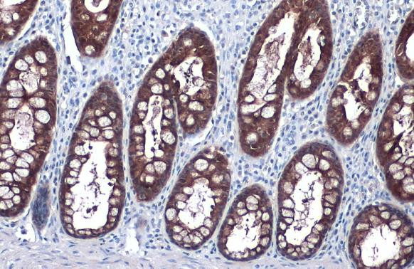 GPX2 Antibody in Immunohistochemistry (Paraffin) (IHC (P))