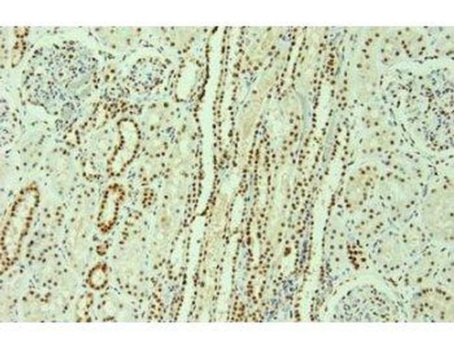 hnRNP F/H Antibody in Immunocytochemistry (ICC/IF)