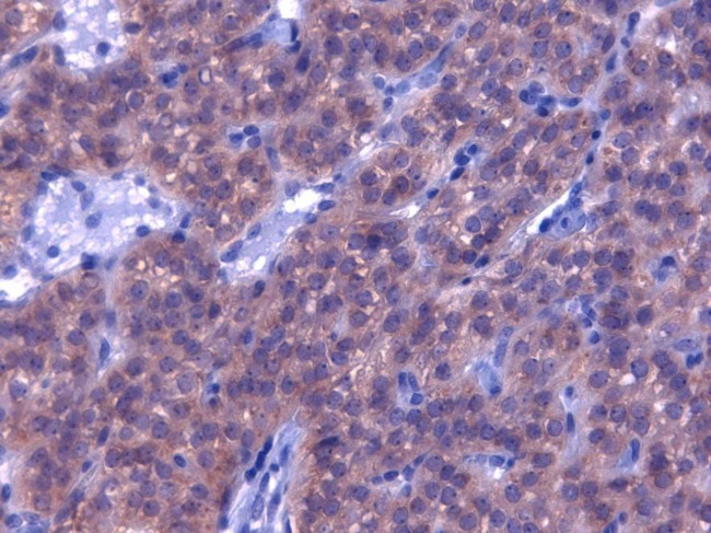 PTH Antibody in Immunohistochemistry (Paraffin) (IHC (P))