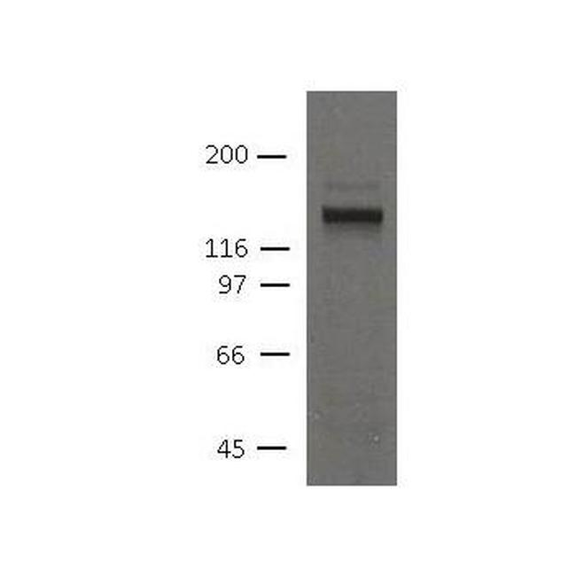 Desmoglein 2 Antibody in Western Blot (WB)