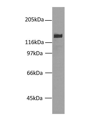 Desmoglein 2 Antibody in Western Blot (WB)