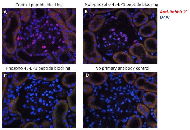 Phospho-4EBP1 (Thr37, Thr46) Antibody in Immunohistochemistry (IHC)