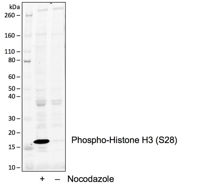 Phospho-Histone H3 (Ser28) Antibody in Western Blot (WB)