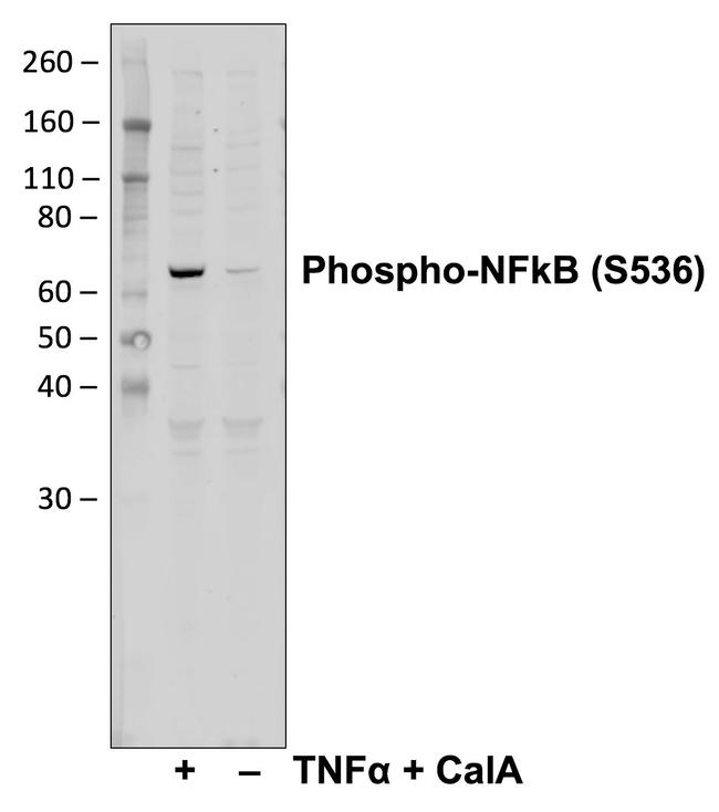 Phospho-NFkB p65 (Ser536) Antibody in Western Blot (WB)